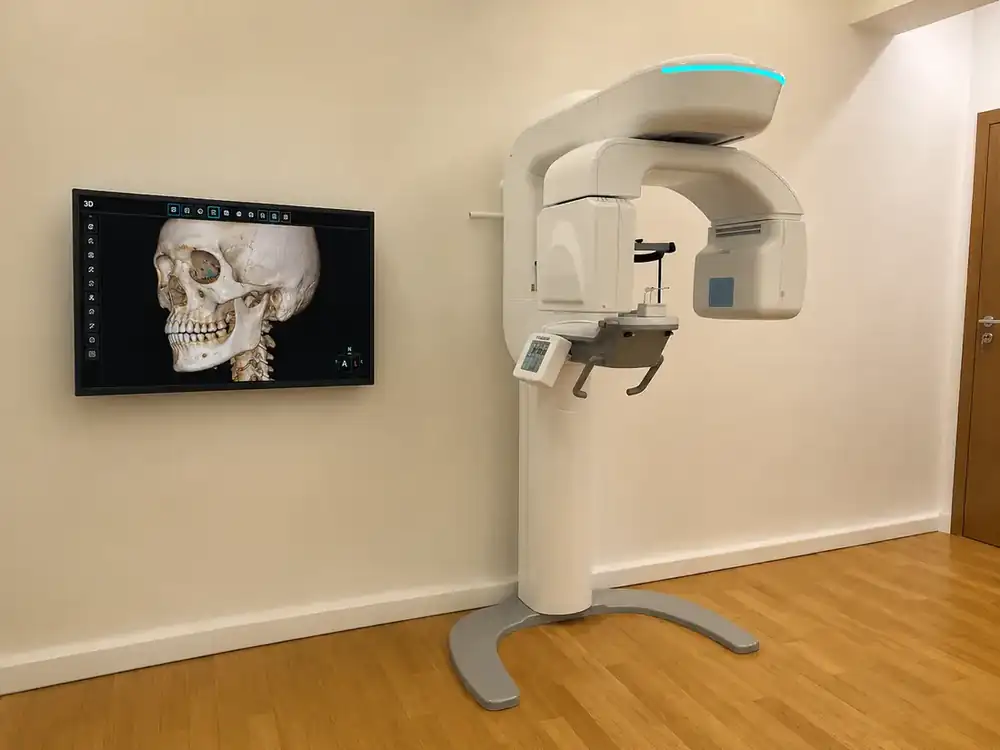 CBCT unit in the clinic
